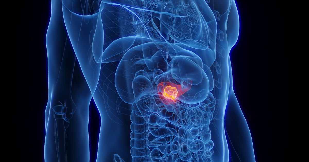 Major cancer breakthrough as lifestyle choice tied with deadly disease - Daily Star